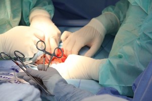 В Московском областном онкологическом диспансере провели уникальную операцию Женщина с раком яичников третьей стадии и метастазами
